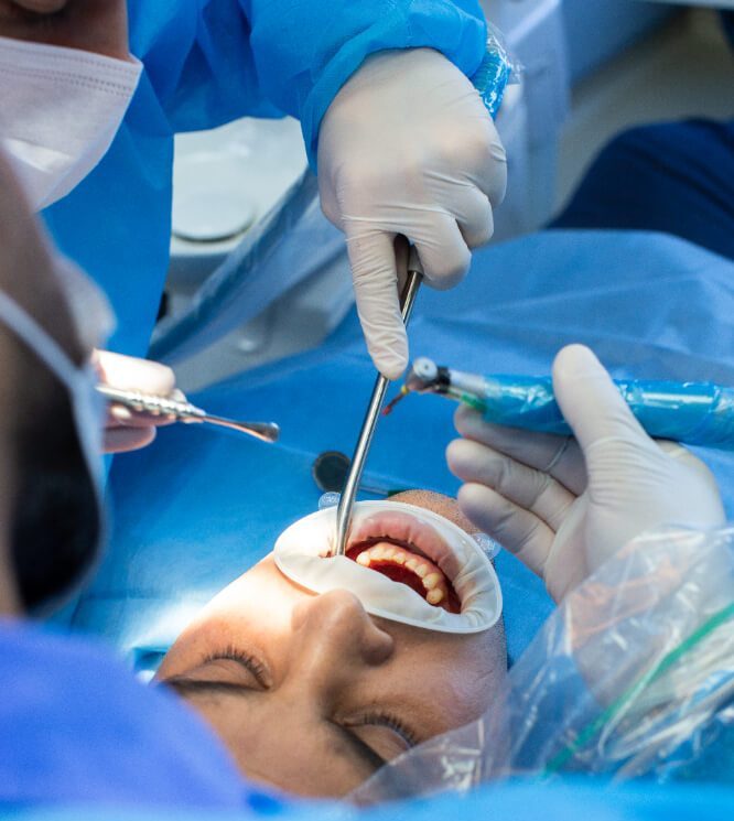 wisdom teeth surgeries | erindale dental centre